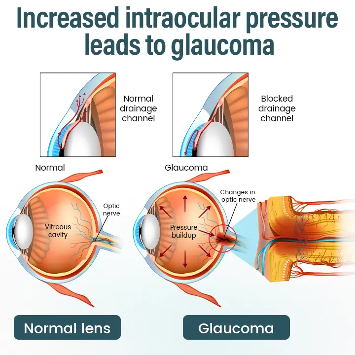 OptiFusion Nano Eye Drops Serum - Image 5