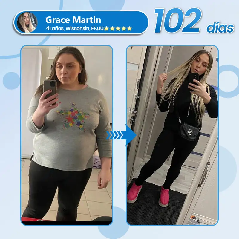 con y Matrixyl 3000 - Image 3