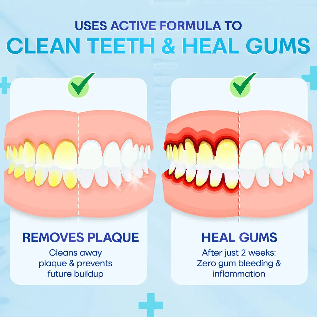 Gum Therapy Agent - Image 4