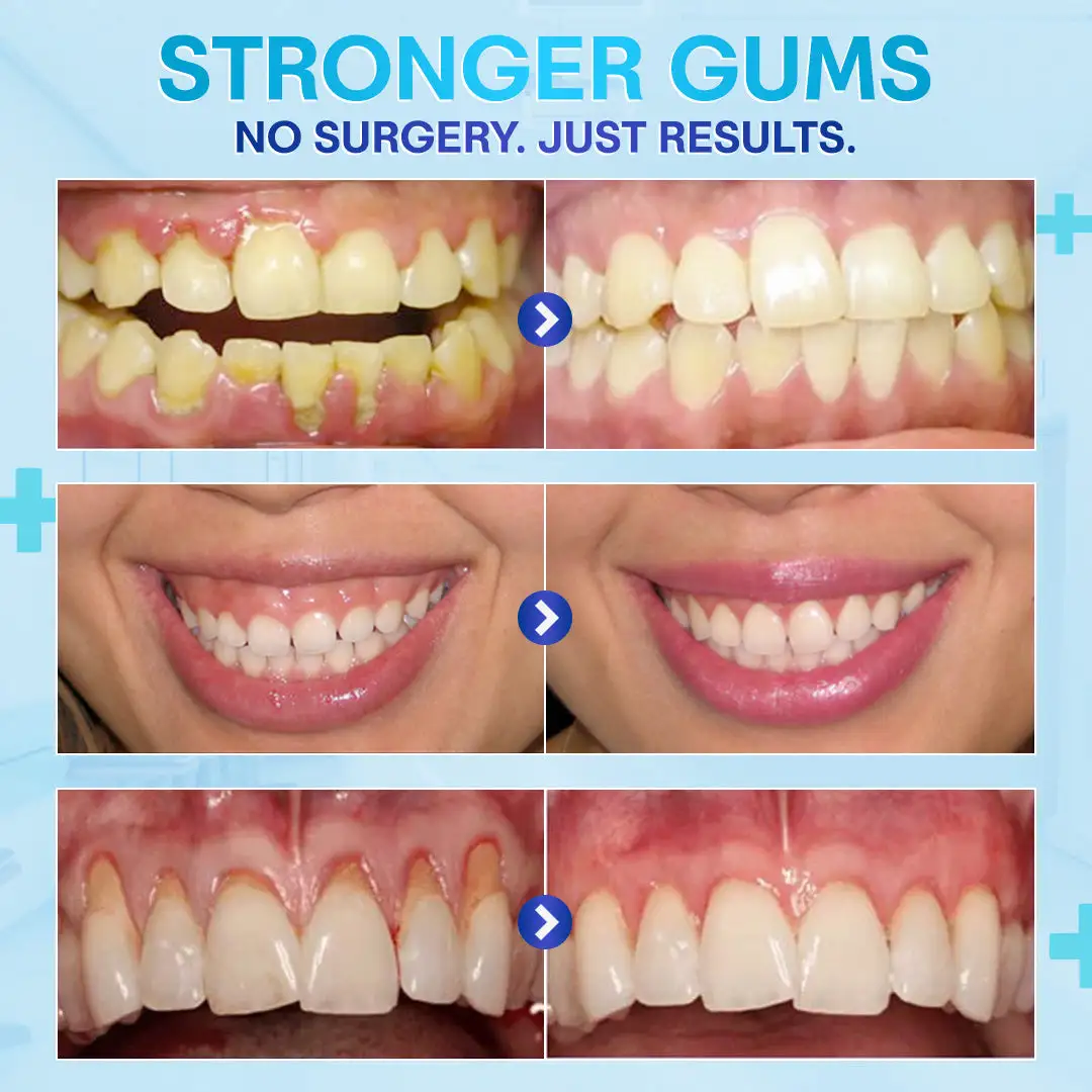 Gum Therapy Agent - Image 6