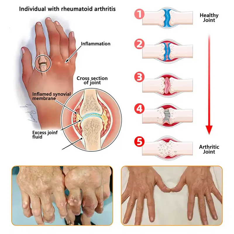 Bee Venom Pain-Relief Joint Soothing Spray - Image 10