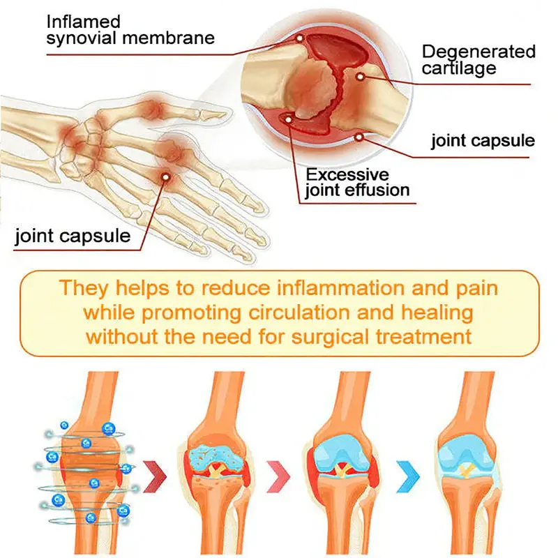 Bee Venom Pain-Relief Joint Soothing Spray - Image 15