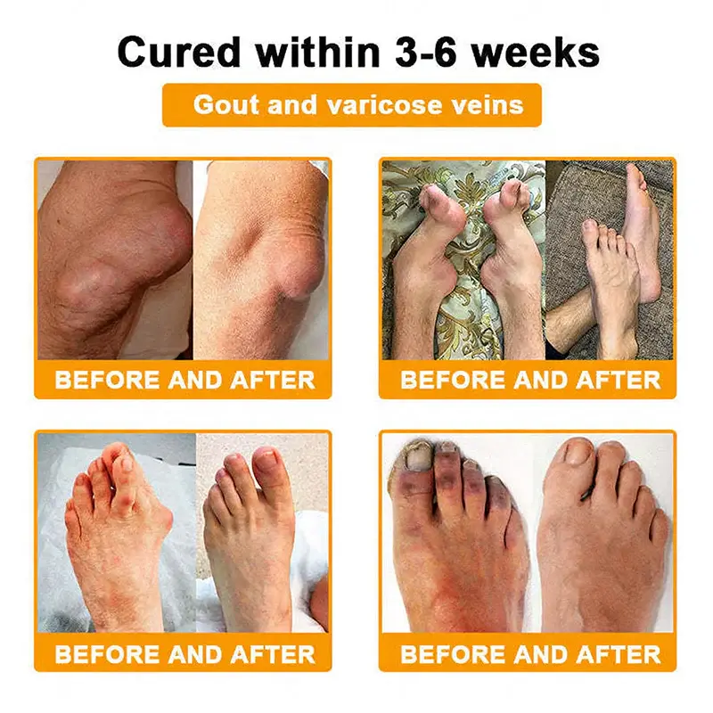 Bee Venom Pain-Relief Joint Soothing Spray - Image 2