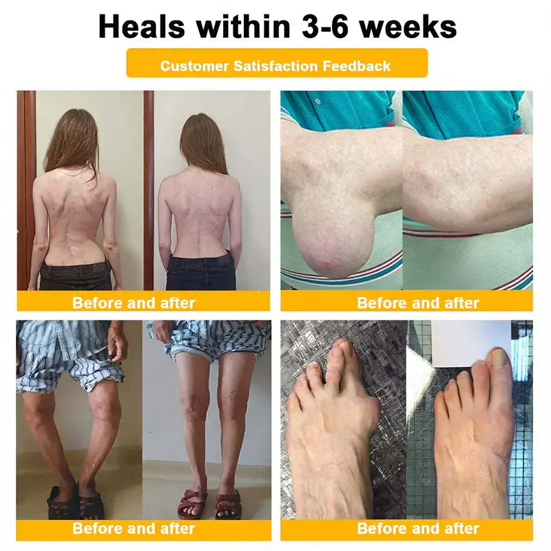 Bee Venom Pain-Relief Joint Soothing Spray - Image 3