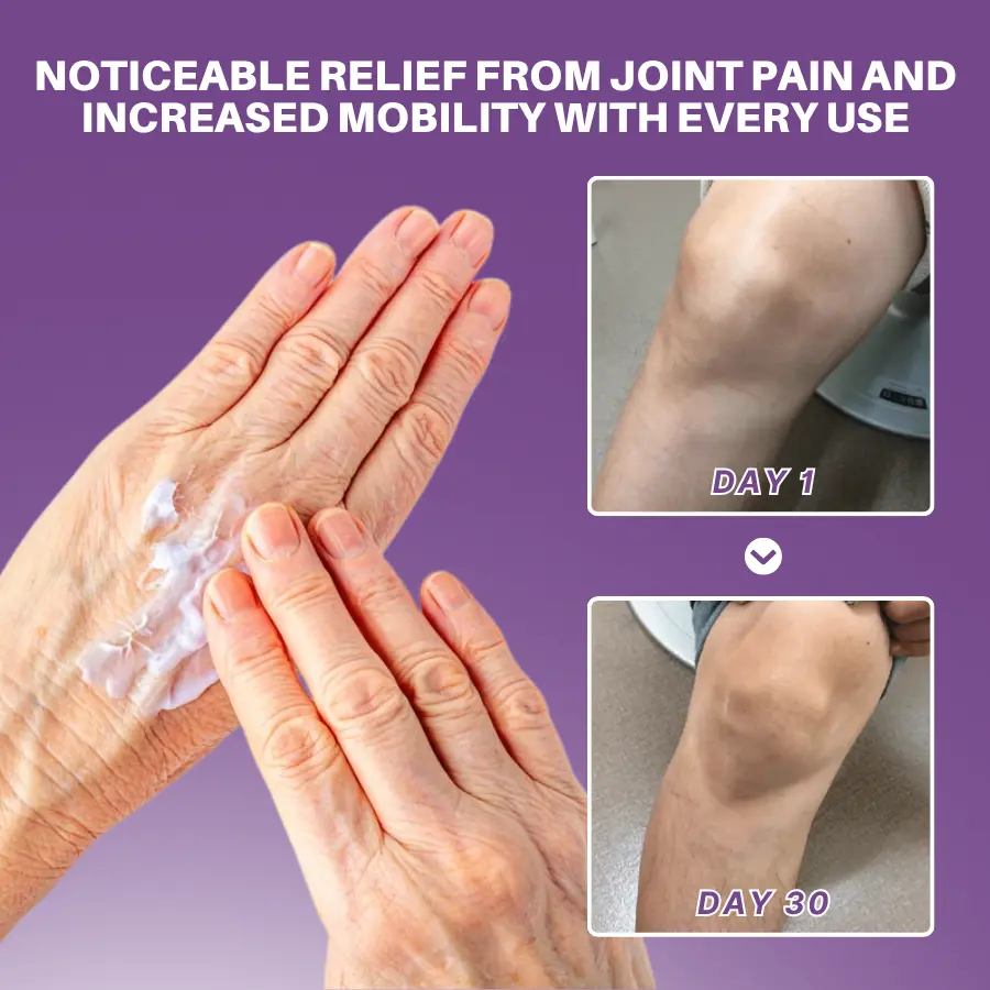 Turmeric & Emu Oil Arthritis Soothing Pain Relief Gel - Image 3