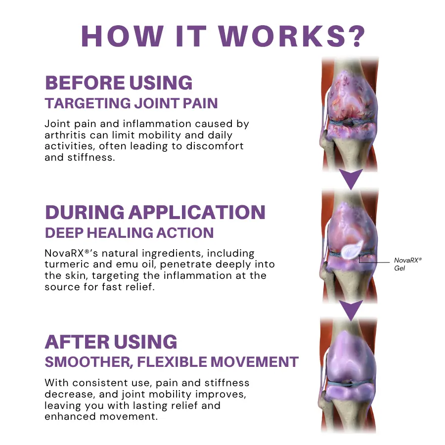 Turmeric & Emu Oil Arthritis Soothing Pain Relief Gel - Image 4