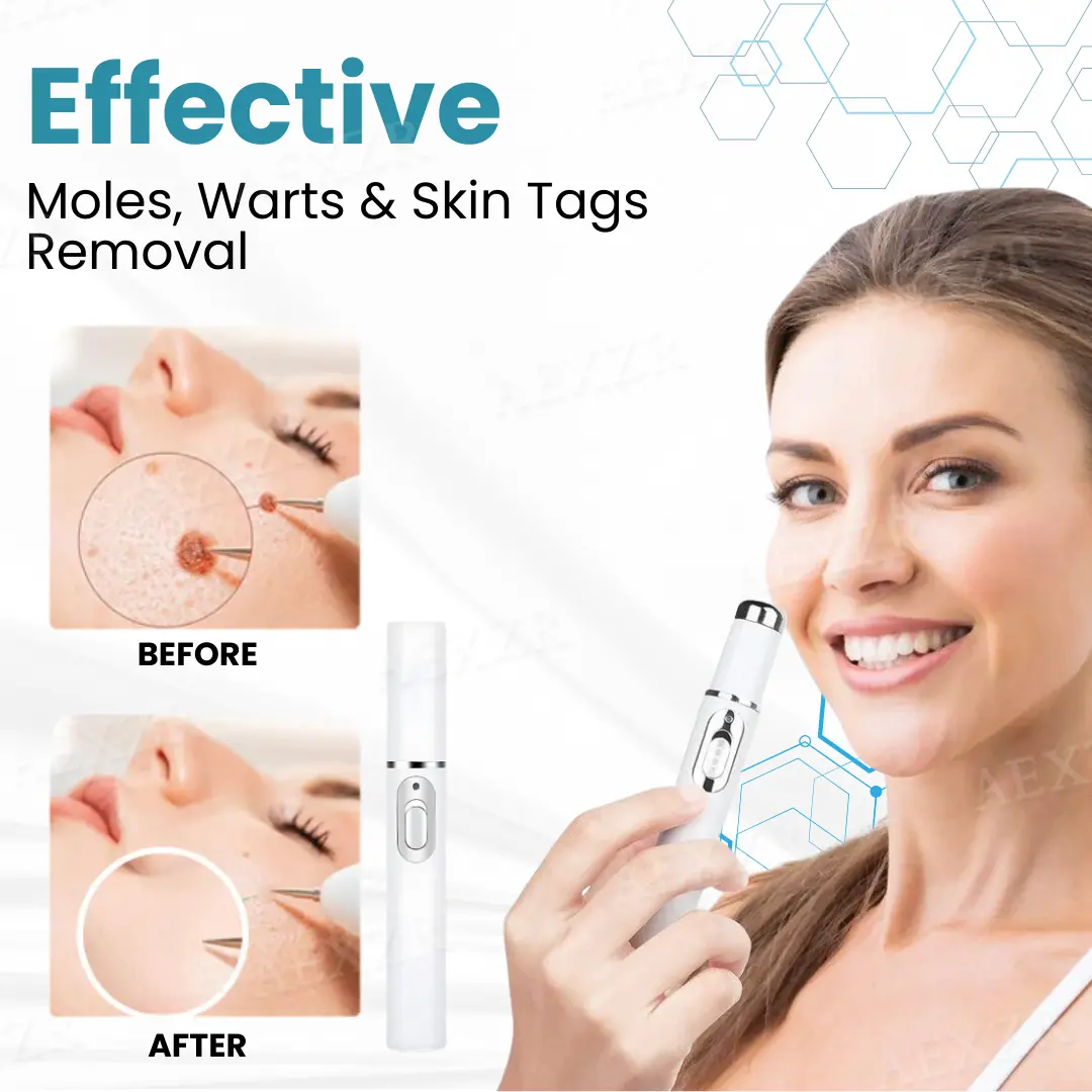 Non-invasive Mole and Wart Removal Laser Pen - Image 5