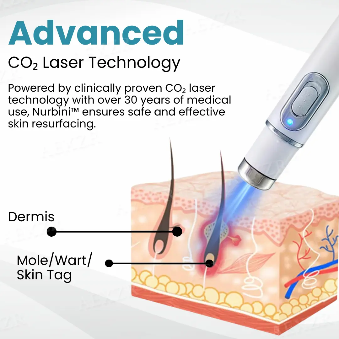 Non-invasive Mole and Wart Removal Laser Pen - Image 6