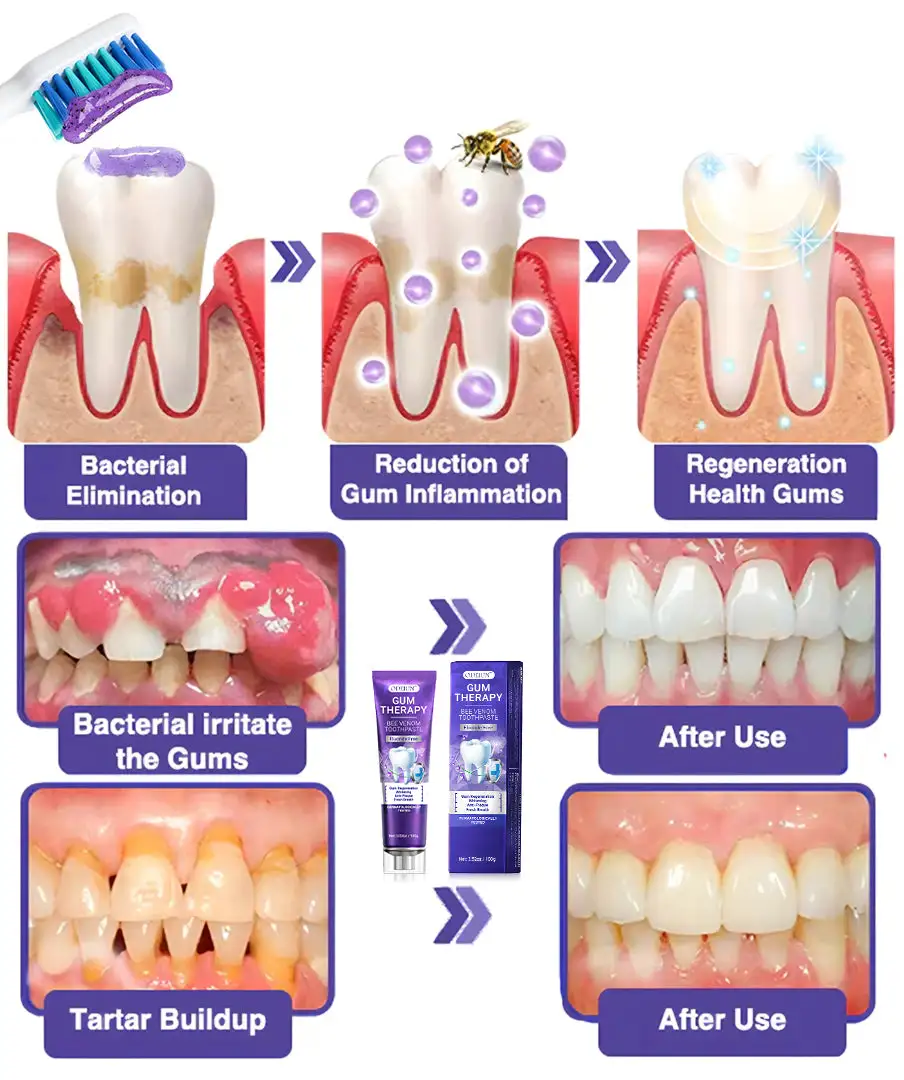 Bee Venom Dental Treatment Toothpaste - Image 11