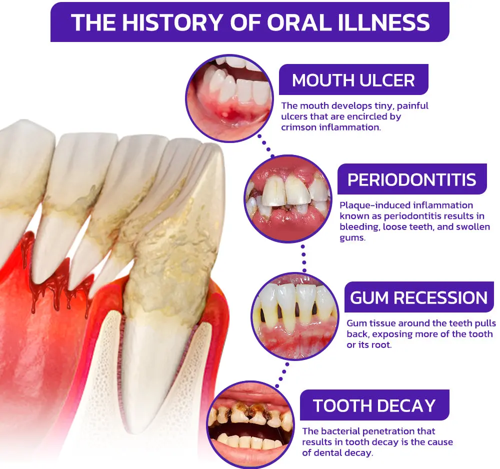 Bee Venom Dental Treatment Toothpaste - Image 5