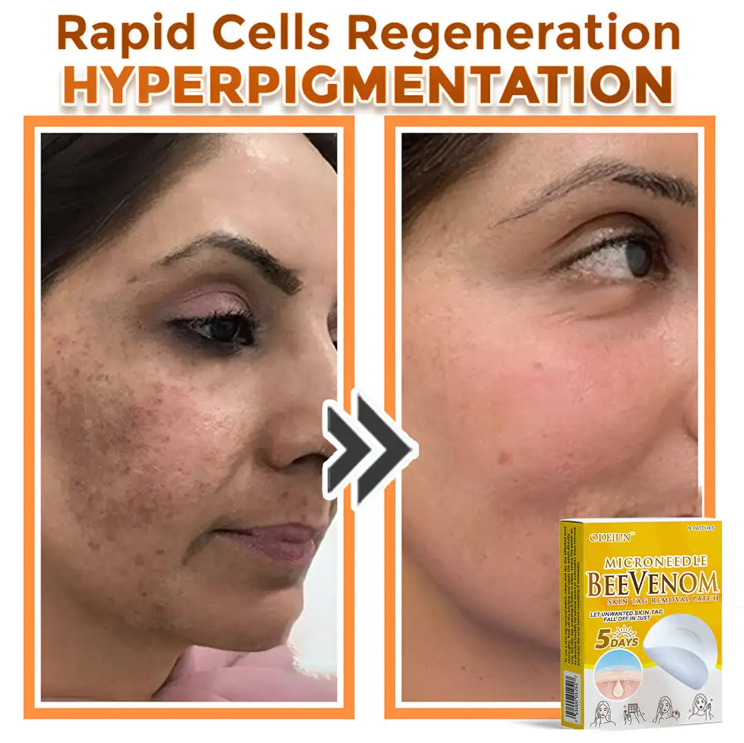 Bee Venom Microneedle Patch - Image 2