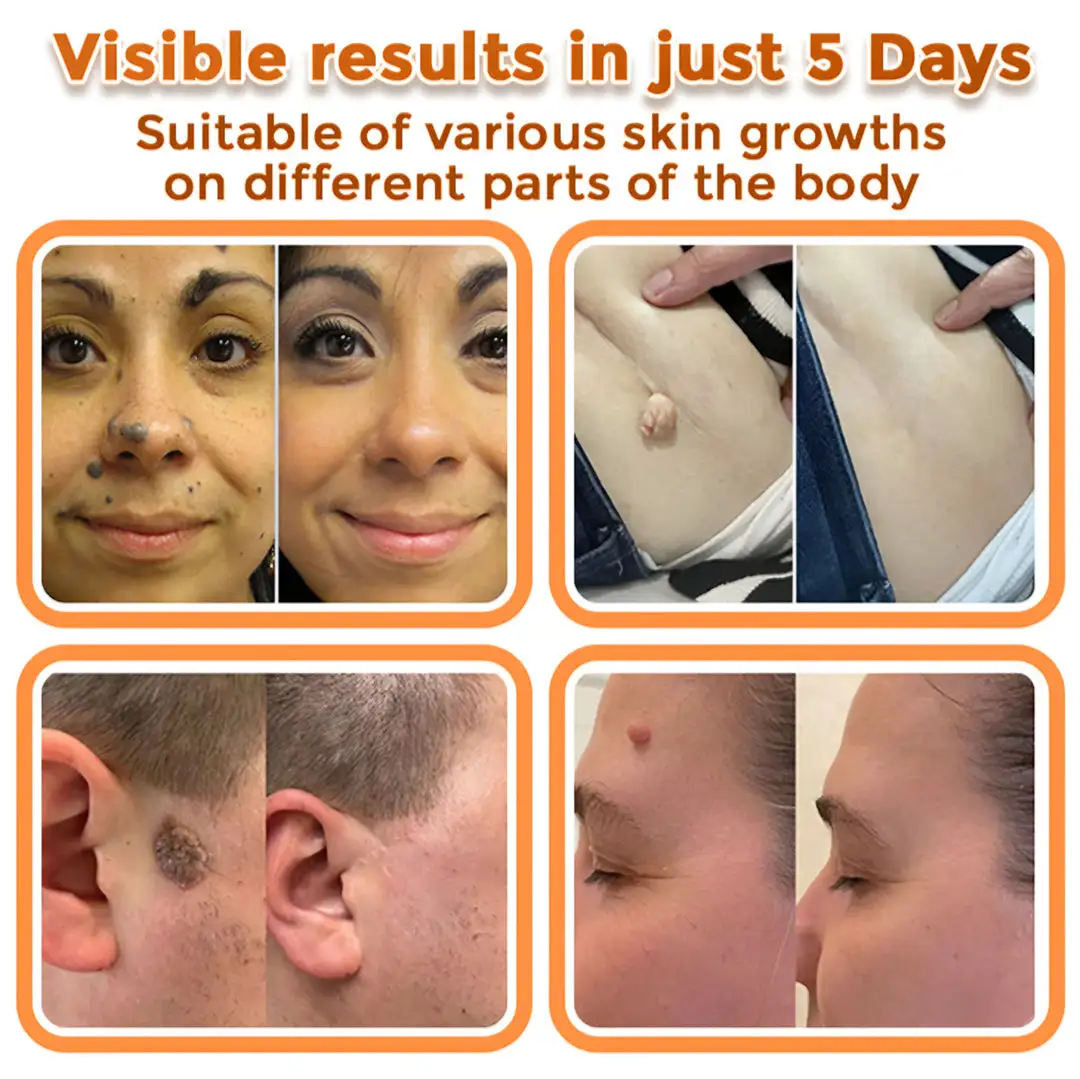 Bee Venom Microneedle Patch - Image 3