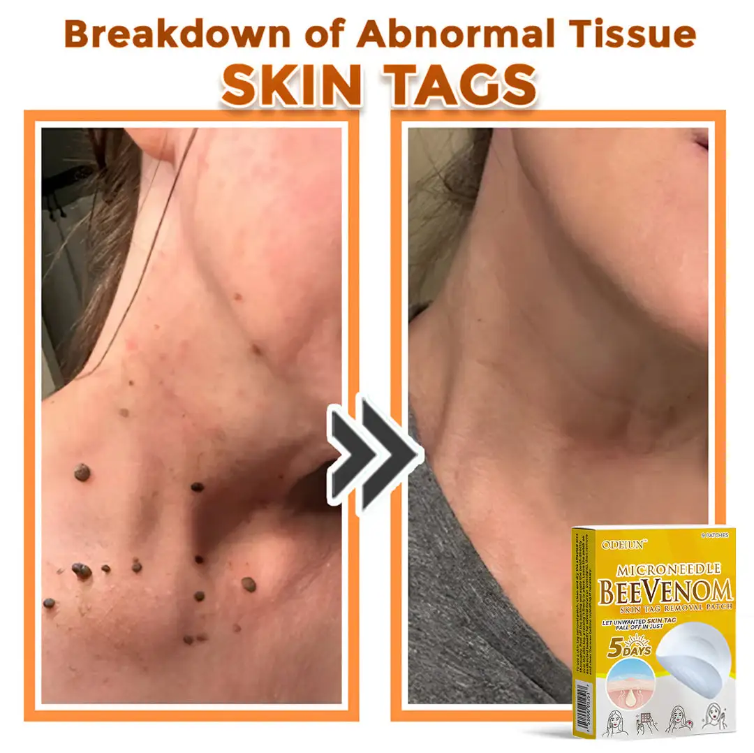 Bee Venom Microneedle Patch - Image 4