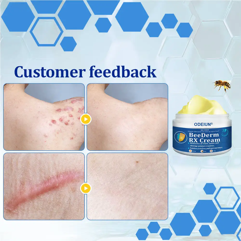 BeeDerm RX Cream - Image 16