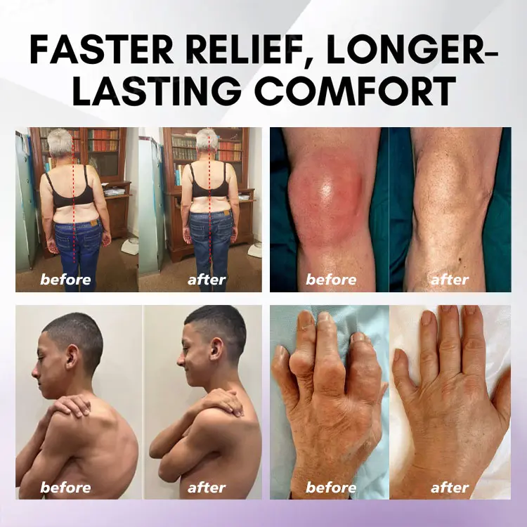 Turmeric & Emu Oil Arthritis Soothing Pain Relief Massage Gel - Image 2