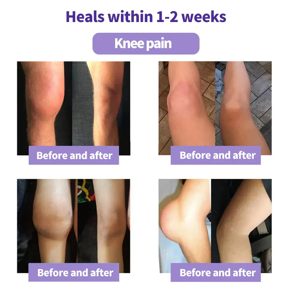 Turmeric & Emu Oil Arthritis Soothing Pain Relief Massage Gel - Image 3