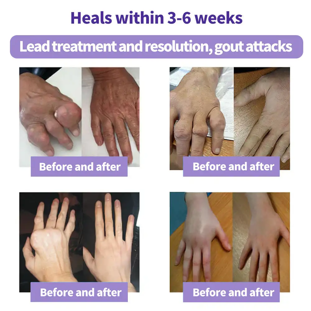 Turmeric & Emu Oil Arthritis Soothing Pain Relief Massage Gel - Image 4