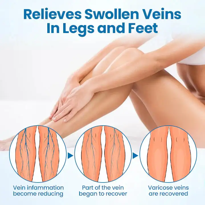 VeinGuard Herbal Spray - Image 3