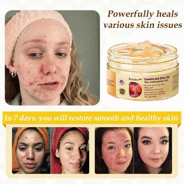 Turmeric and Emu Oil Skin Antibacterial Gel - Image 2