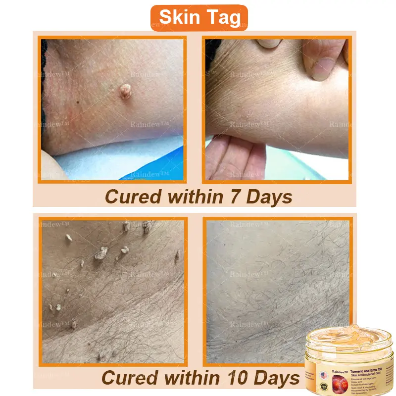 Turmeric and Emu Oil Skin Antibacterial Gel - Image 3