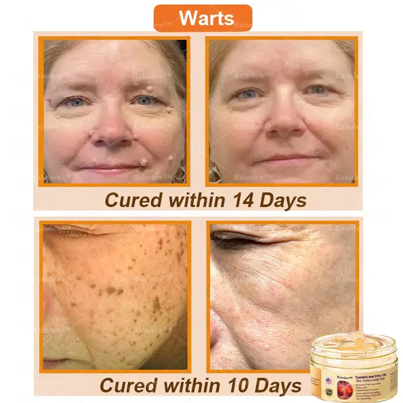 Turmeric and Emu Oil Skin Antibacterial Gel - Image 4