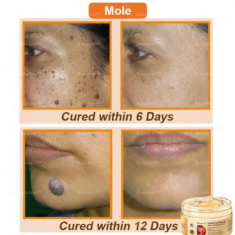 Turmeric and Emu Oil Skin Antibacterial Gel - Image 5