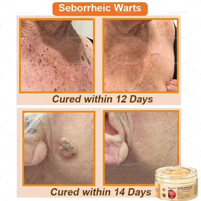 Turmeric and Emu Oil Skin Antibacterial Gel - Image 6