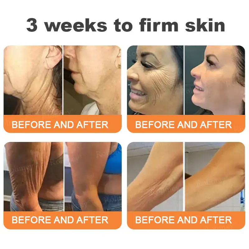 Instant FirmLift Temporary EYE Tightener - Image 3