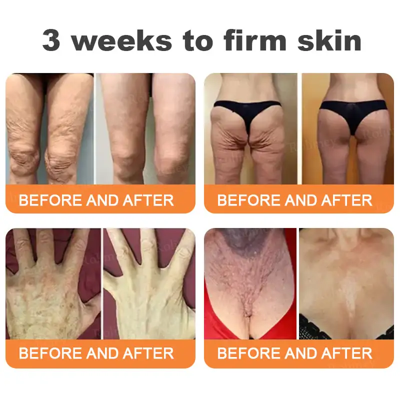 Instant FirmLift Temporary EYE Tightener - Image 4