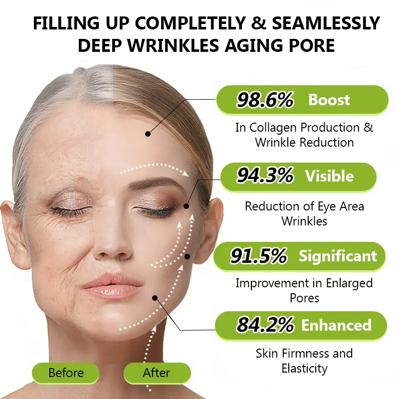 BOTOX & VITA A RETINOL SHOT Wrinkle Lift Tightening Cream - Image 13