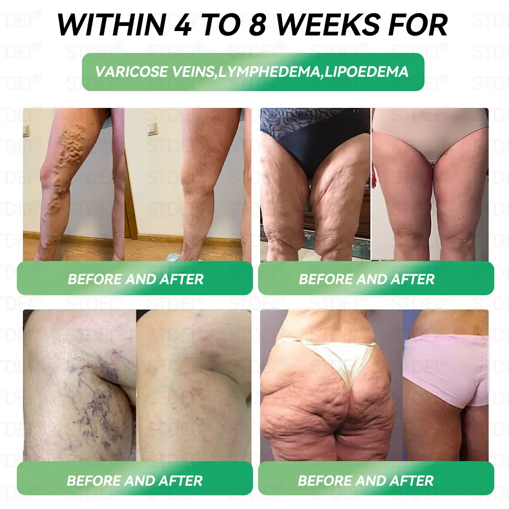 Microcapsule Burst Patch - Image 8