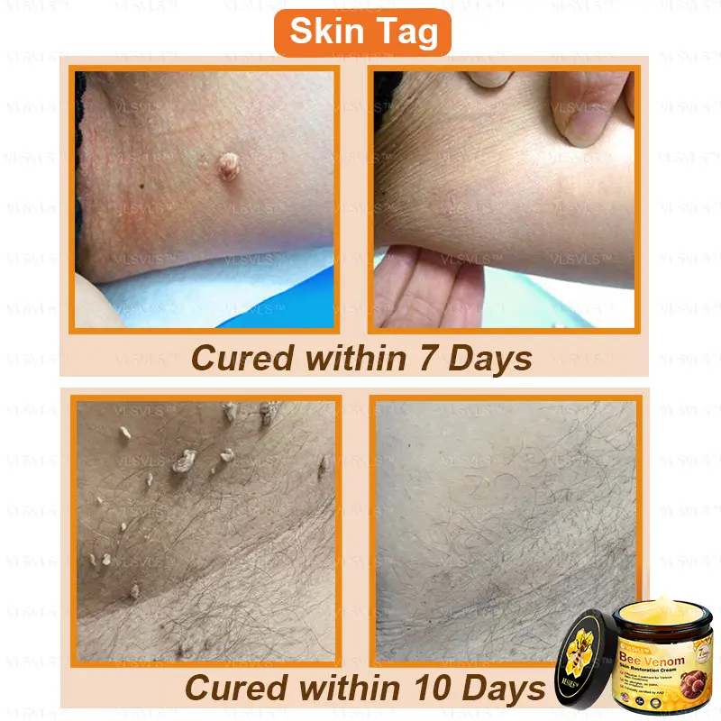 Bee Venom Skin Restoration Cream - Image 3