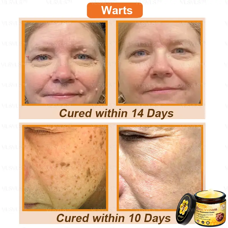 Bee Venom Skin Restoration Cream - Image 4