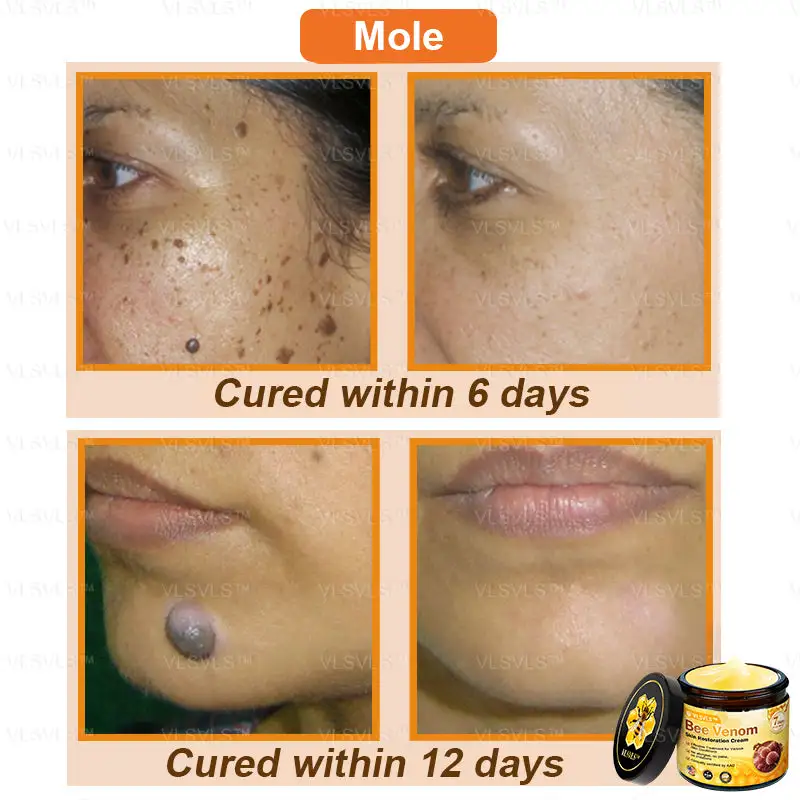 Bee Venom Skin Restoration Cream - Image 5
