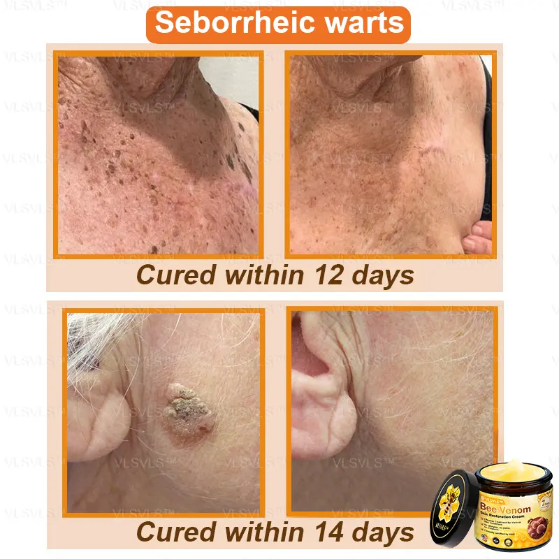 Bee Venom Skin Restoration Cream - Image 6