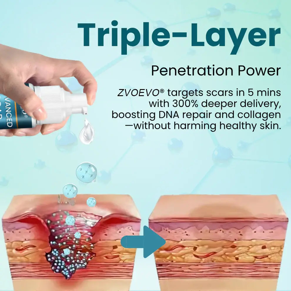 Advanced Scar Gel for Surgical Scars - Image 5