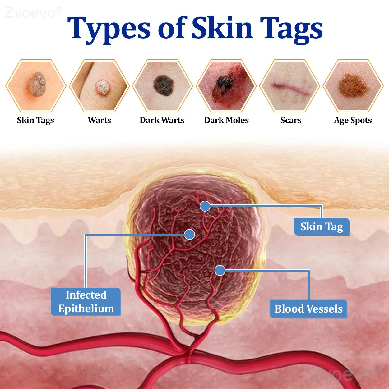 BeeDerm RX Cream - Image 14