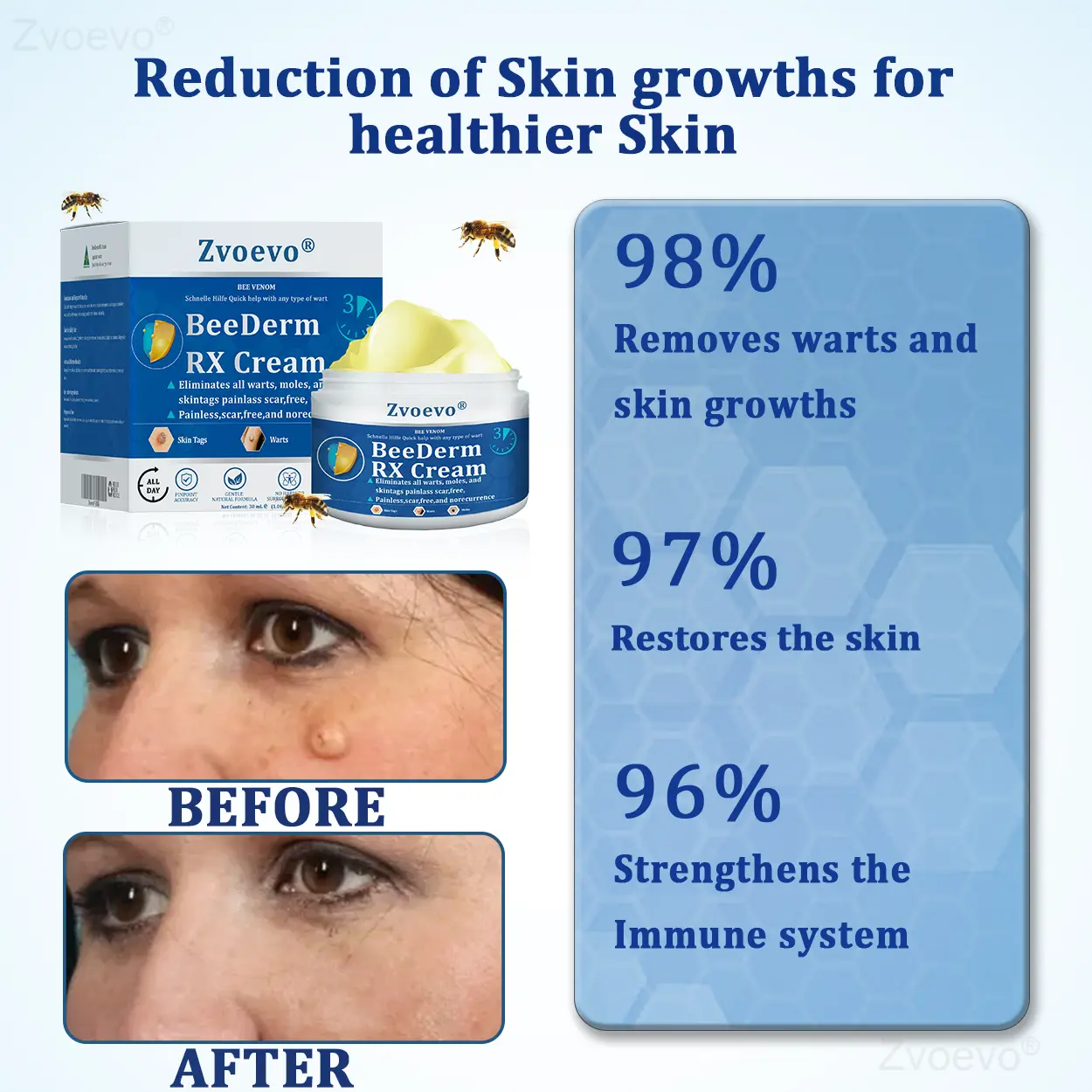BeeDerm RX Cream - Image 3