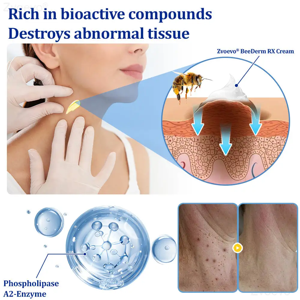 BeeDerm RX Cream - Image 31