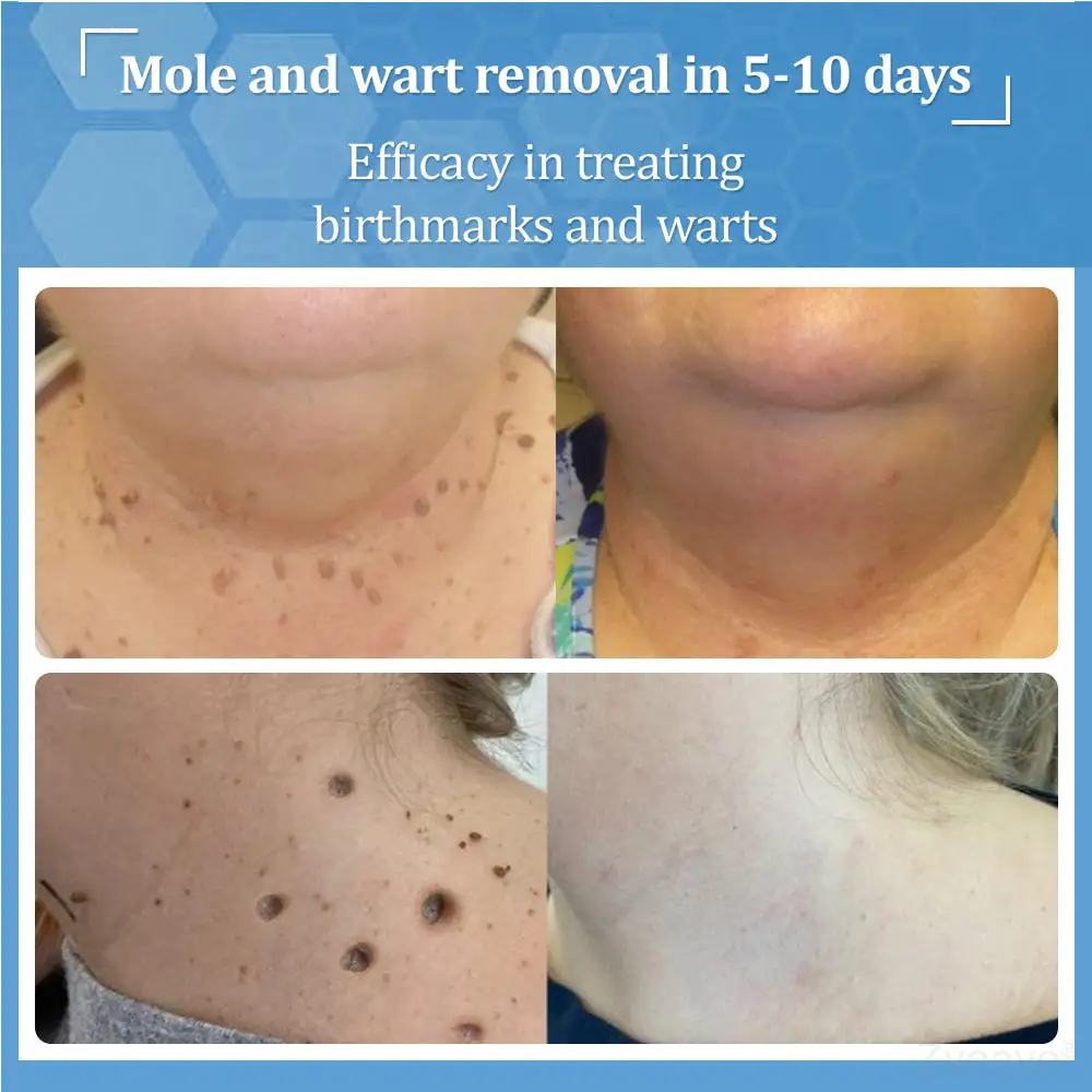 BeeDerm RX Cream - Image 5