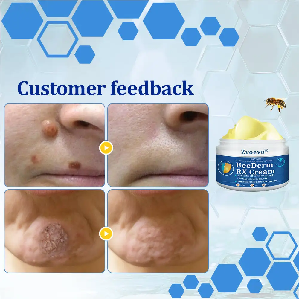 BeeDerm RX Cream - Image 6