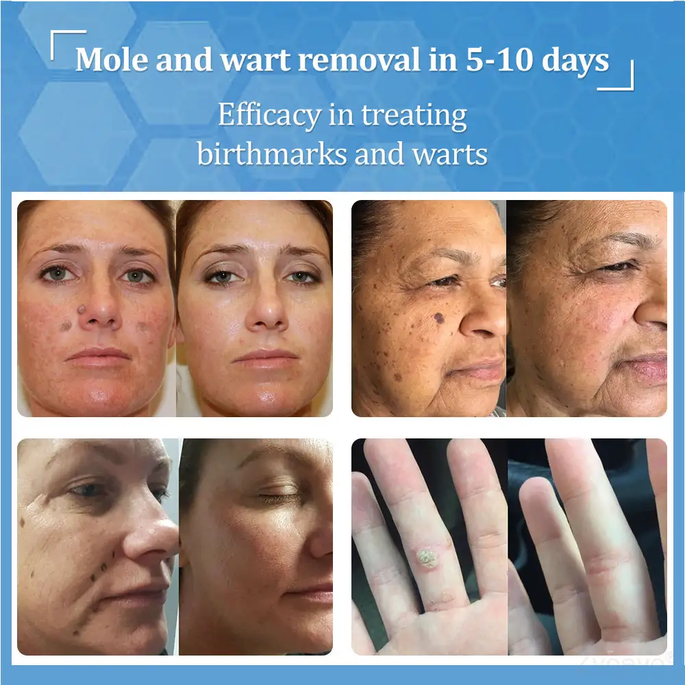 BeeDerm RX Cream - Image 8