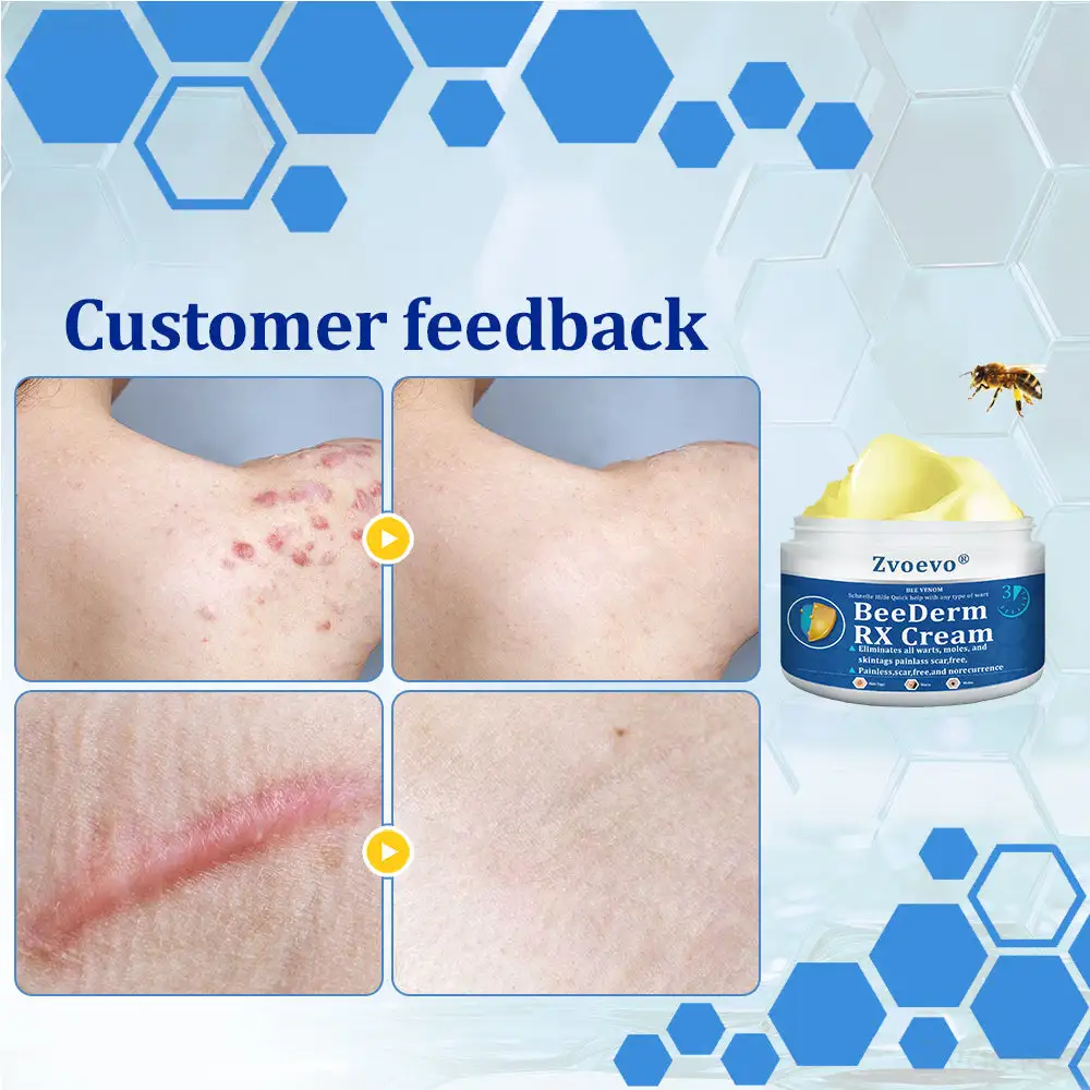 BeeDerm RX Cream - Image 9