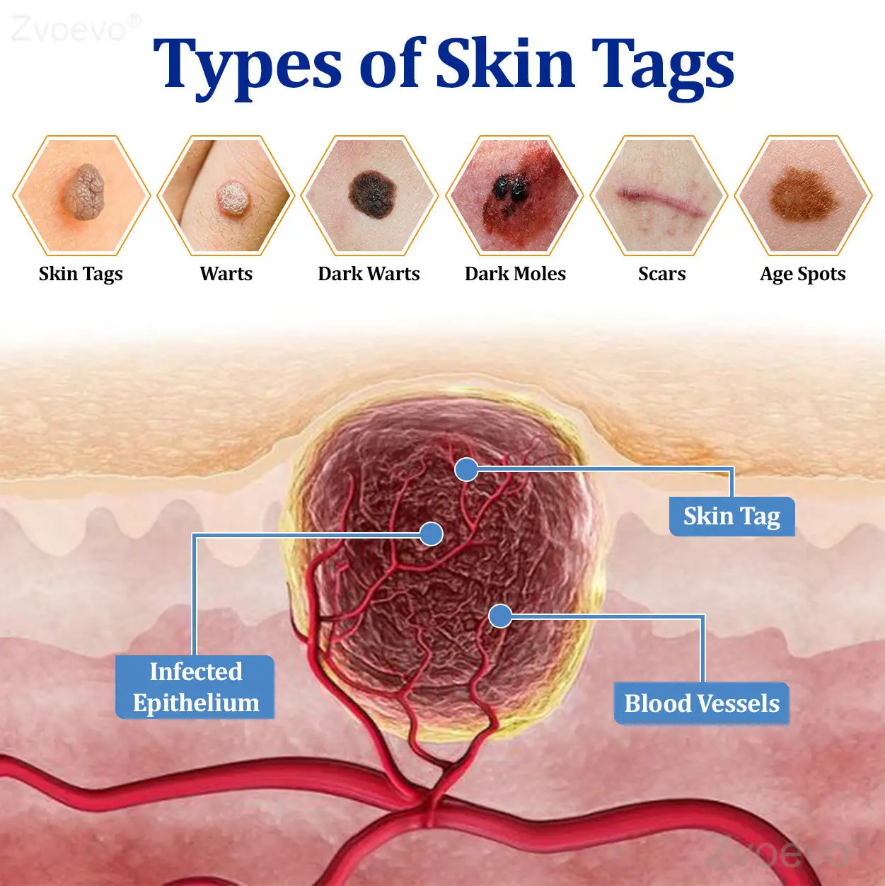 BeeDerm RX Solution - Image 13