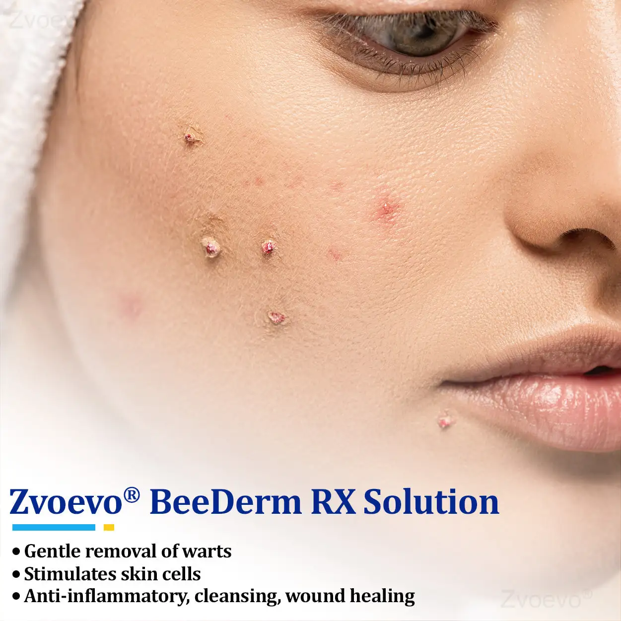 BeeDerm RX Solution - Image 14