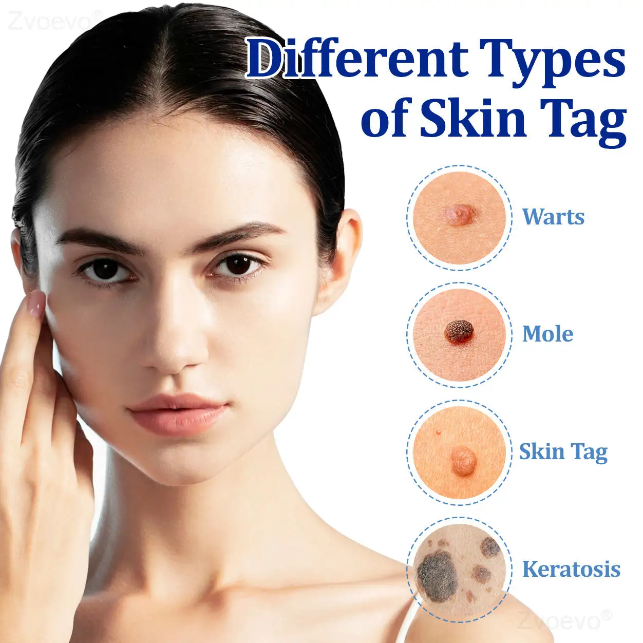 BeeDerm RX Solution - Image 15