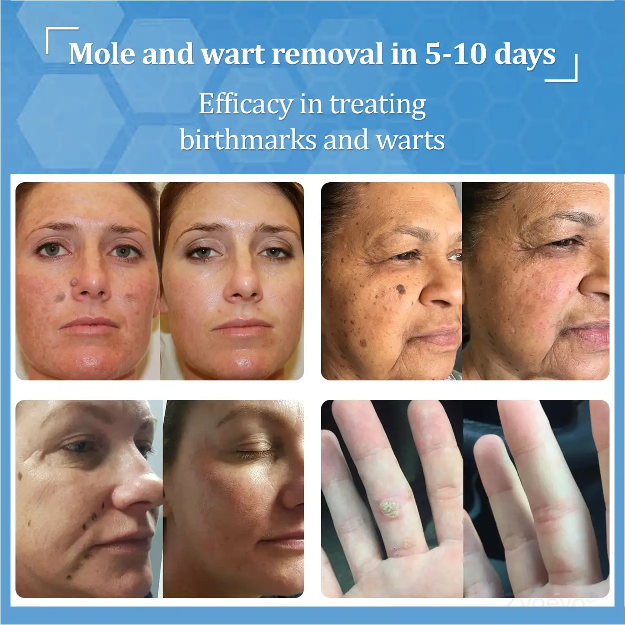 BeeDerm RX Solution - Image 2