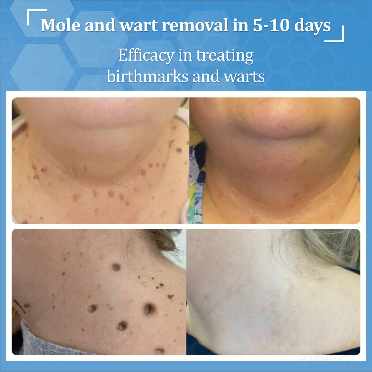 BeeDerm RX Solution - Image 24