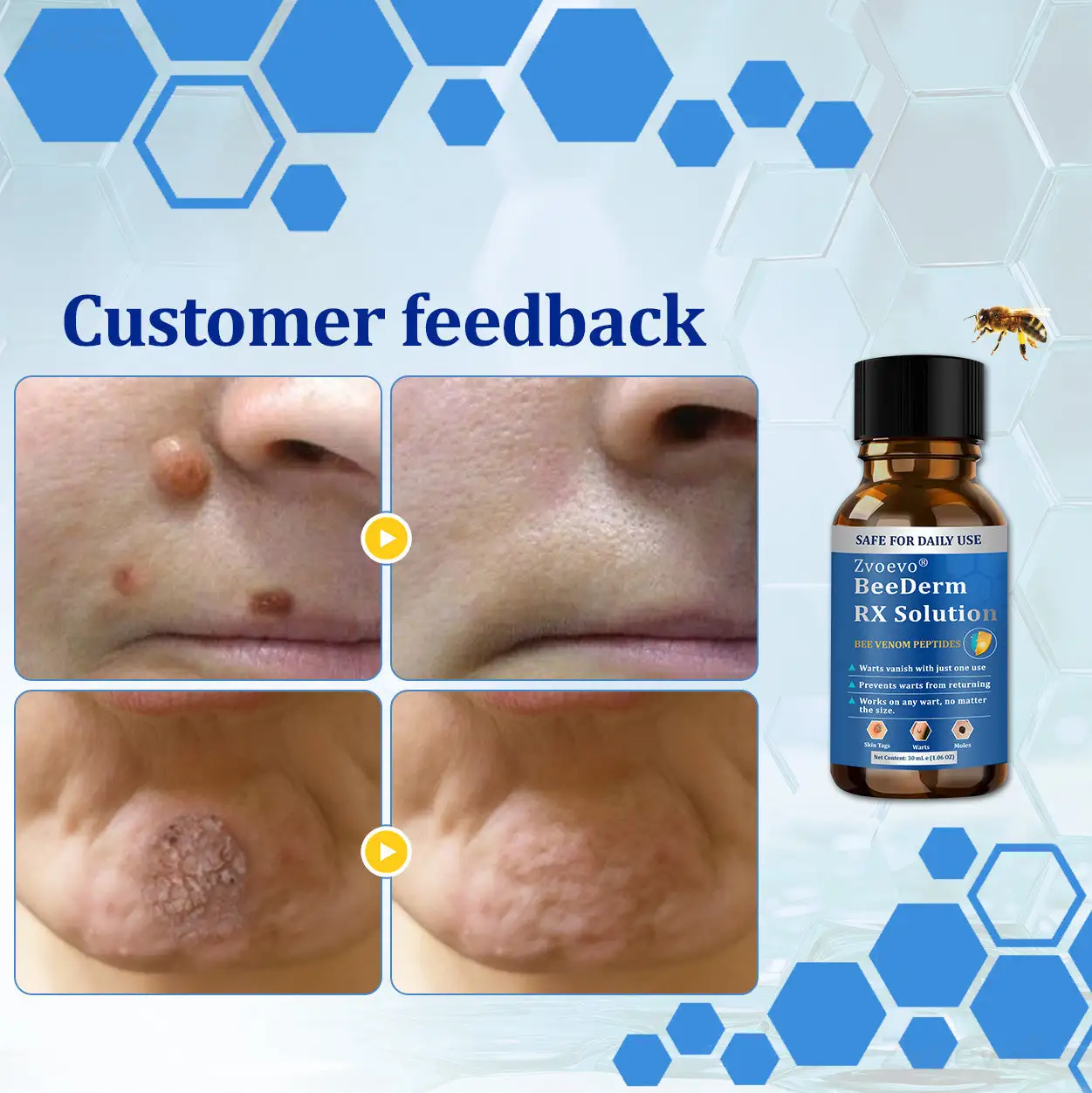 BeeDerm RX Solution - Image 25