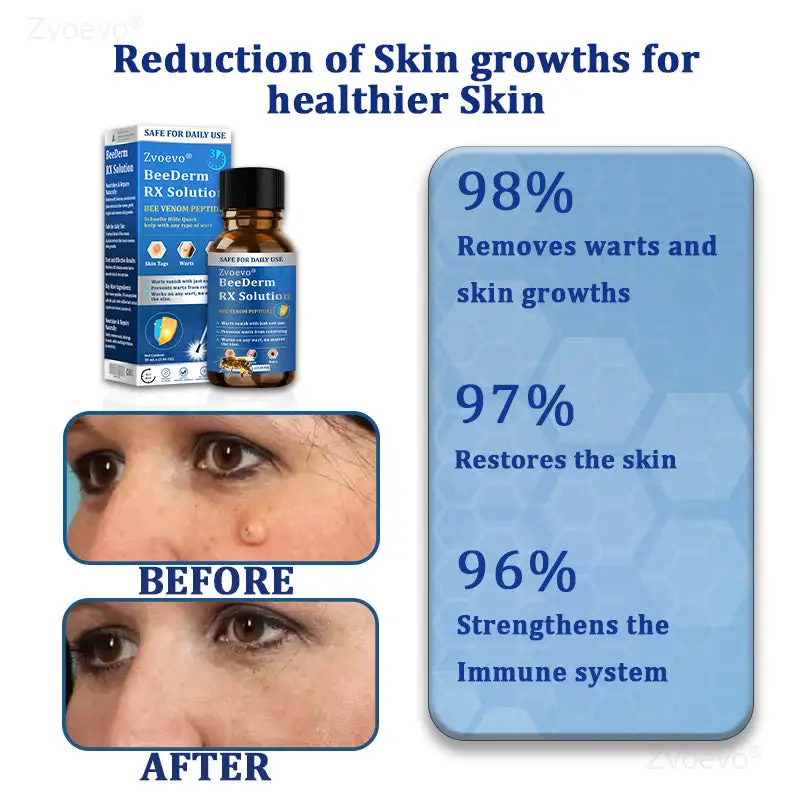 BeeDerm RX Solution - Image 27